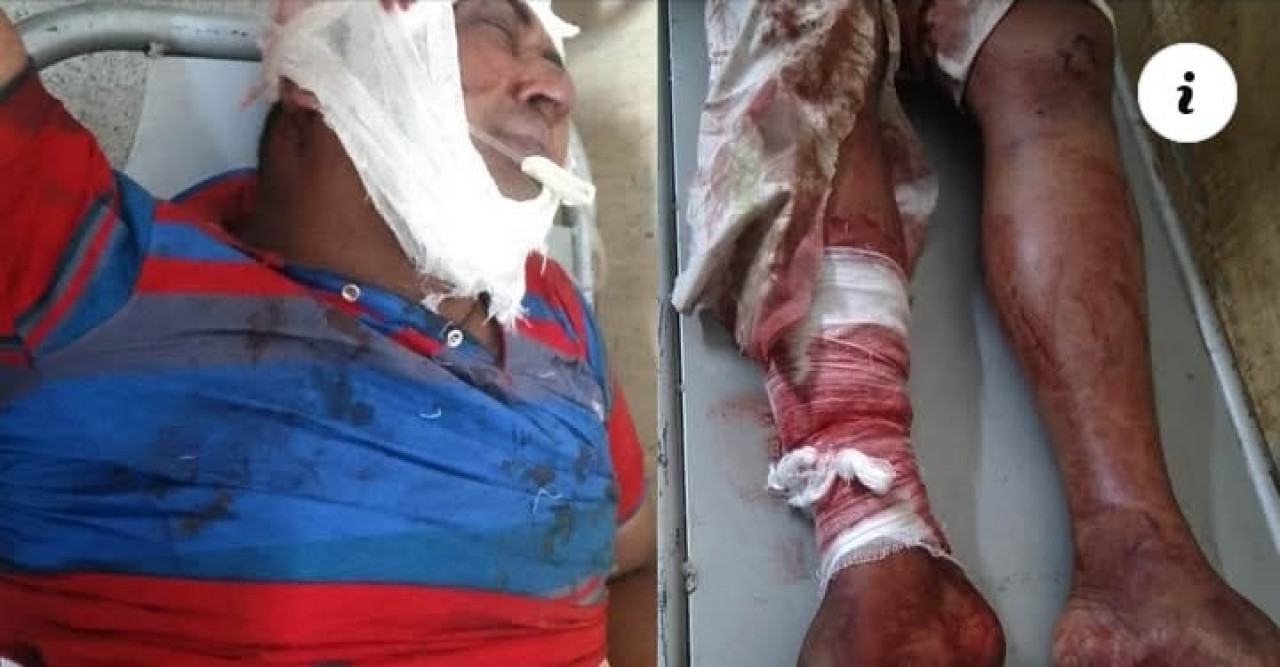 শার্শায় পূর্ব শত্রুতার জেরে যুবককে কুপিয়ে জখম