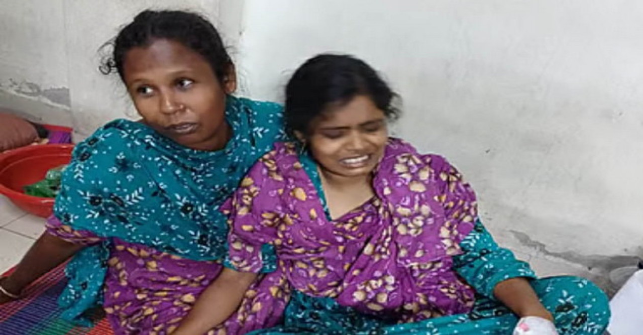 বাগমারায় গৃহবধূকে এসিডে পুরিয়ে হ’ত্যা চেষ্টার অভিযোগ